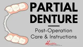 What To Do After Getting a Partial (Denture) | #experienceHFD