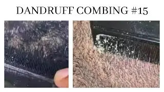 Dandruff combing #15