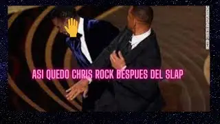 asi quedo el presentador Chris Rock despues que Will Smith golpeara  al comediante