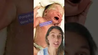 ¿Qué es la VÉRNIX CASEOSA que tienen los bebés al nacer?