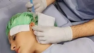 Отопластика - операция на уши)))
