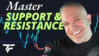 Master Support and Resistance Trading Today! 😱