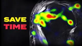My 7-Second Habit ALL Radiologists Need To Know