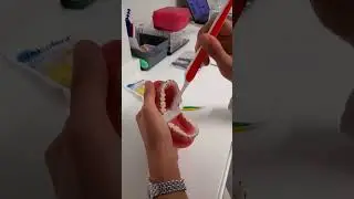 İmpladent - Ortodontide Diş Fırçalama