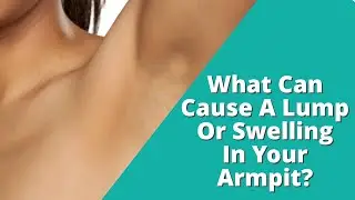 I've Found A LUMP in My Armpit. It Is PAINFUL, Could This Be CANCER?