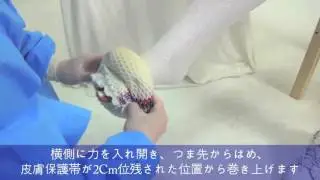 Video of Wearing Procedure (Long Leg)