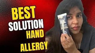 Best Treatment for hand eczema or hand allergy | 9999 747 717
