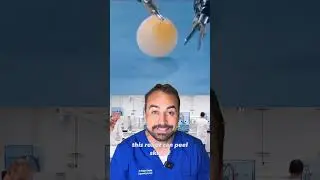 Robotic pimples #skincare #blackheads dr Khaled Sadek explains