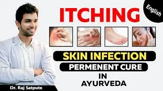 How to Get Rid of Any Skin Infection Naturally & Permanently At Home | Dr. Raj Satpute | JYOVIS