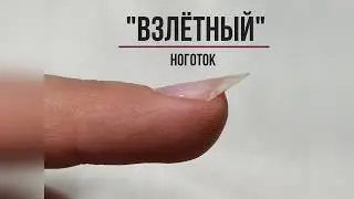 Исправление взлётного ноготка