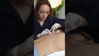 Did you watch this back exam video? 