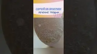 Лечение трещин #трещинынапятках #трещины #подология #подолог #стопы #стопа #педикюр