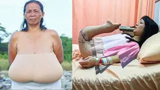 10 Odd And Bizarre People You Won't Believe Actually Exist