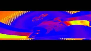 Seven Crazy Seizures (EPILEPSY WARNING)