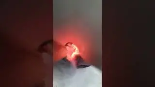 Спазм голосовой щели