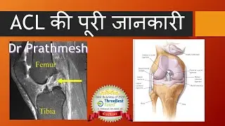 All About ACL In detail (Hindi) ACL की विस्तृत जानकारी Everything about ACL , A to Z about ACL