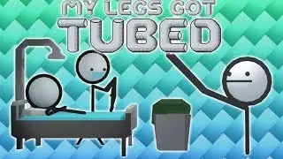 Who Needs Legs Anyways | My Legs Got Tubed