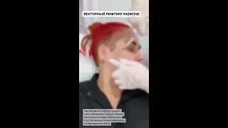 ПРОЦЕДУРА, КОТОРАЯ СОЗДАЕТ КАРКАС ЛИЦА 🔥
