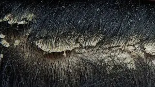 ASMR Ultimate Relaxation Scalp Care #45