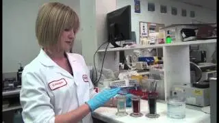 Preparing and Staining Blood Film