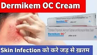 Dermikem oc+ cream Hindi, dermikem oc, dermikem oc cream, dermikem oc plus, dermikem oc cream review