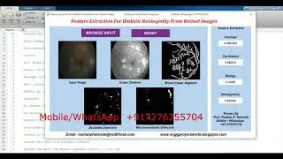 Feature Extraction For Diabetic Retinopathy From Retinal Images Matlab Project With Source Code