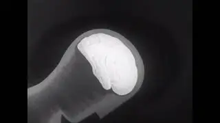 The Hot Bachs - Stomach Full of Dramamine
