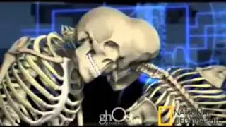 Animation Reel,  Spinal Animations