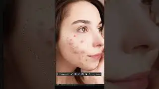Remove Pimples in Photoshop