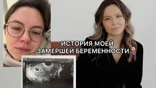МОЯ ЗАМЕРШАЯ БЕРЕМЕННОСТЬ на 8 неделе