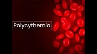 Polycythemia