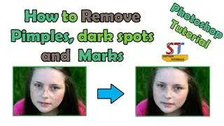 How to Remove Marks from Face in Photoshop