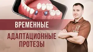 АДАПТАЦИОННЫЕ ПРОТЕЗЫ: ваш ключ к новой УЛЫБКЕ.