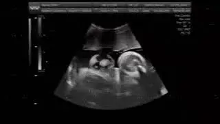 Xeno Wants Out // AlienPregnancy