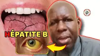 Questions-Réponses : Louy fadj Hépatite B bamou Wérr