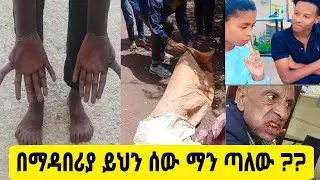 አስገራሚው ባለ 28 ጣቶች ባለቤት በኢትዮጲያ ተገኘ