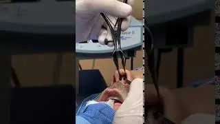 Septoplasty - Septal Incision
