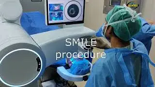 Spectacle free vision/ LASIK/  LASER/ Refractive surgery explained #lasik #eyesurgery #vision