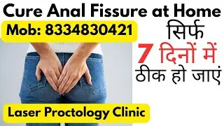 Anal fissure treatment at Home