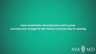 Acne Treatment and Acne Scar Removal