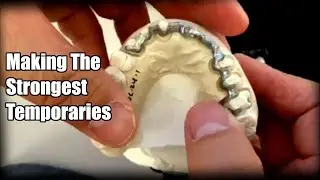 How to Make the Strongest Temporary Restoration