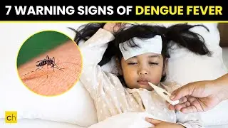 7 Warning Signs of Dengue Fever - #dengue #dengueprevention #denguevirus #dengueawareness