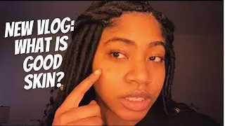 Vlog: What is good skin?