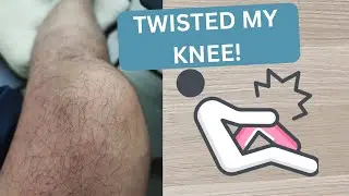 My ACL Tear Recovery Journey: From Twisted Knee to Surgery | Day 15 Pre-Surgery