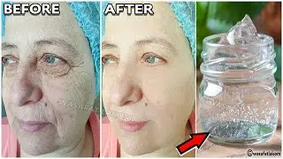 An ingredient, a million times stronger than botox.🌱 apply it on your face, and get rid of wrinkles