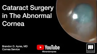 Cataract Surgery in Patients with Abnormal Corneas (Kiawah Eye 2023)