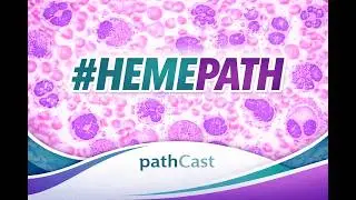 #HEMEPATH Lymphomas and Lymphoid Hyperplasia in the GI Tract