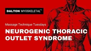 Treatment for Neurogenic Thoracic Outlet Syndrome with Manual Therapy, the MAT Way