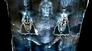 The Shroud of Turin: The Mystery That Science Can’t Explain