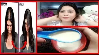 1 ही बार मे बालो का गिरना रोके Stop Hair Fall,DOUBLE Hair growth,Grow Long Hair Overnight 100% Works